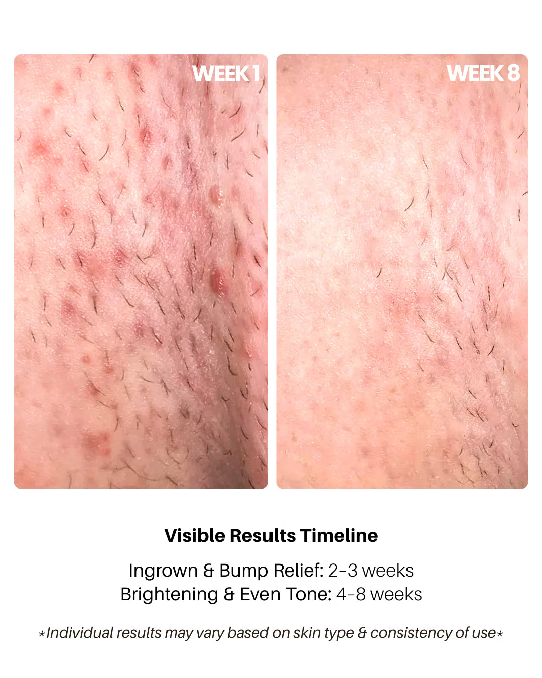 Bright Bikini Line Serum